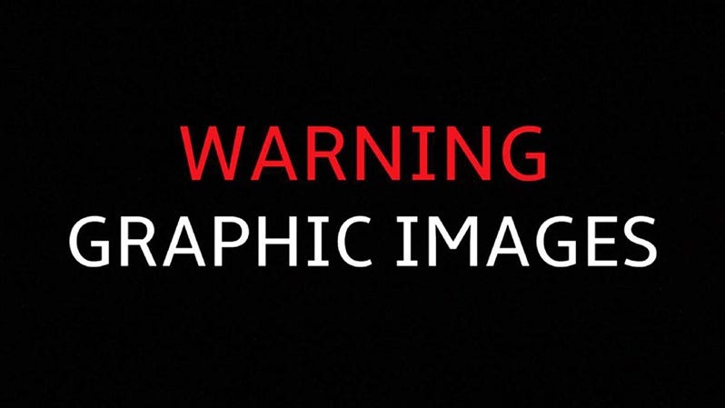 Graphic Images Warning 